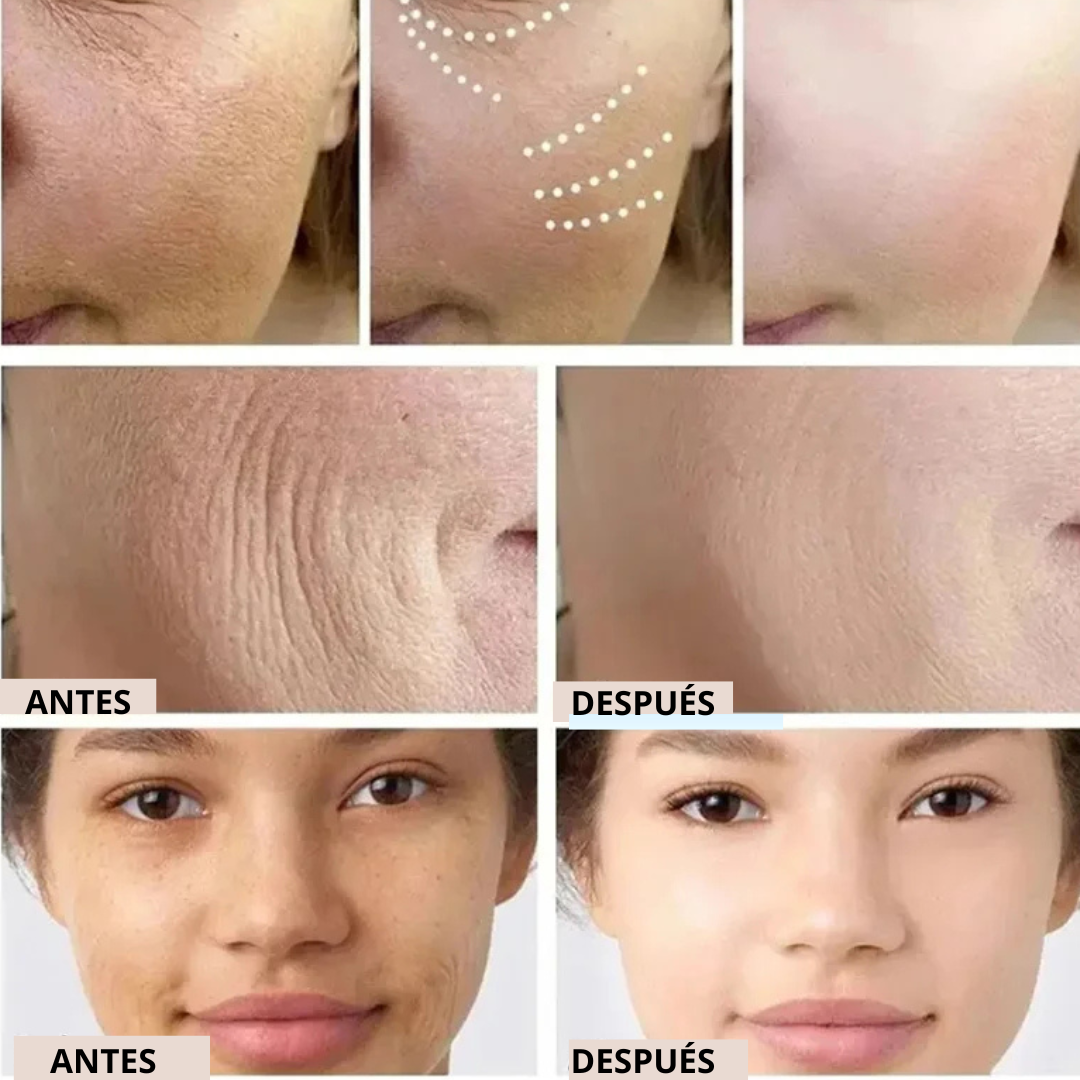 COLLAGEN REVERSE FILM