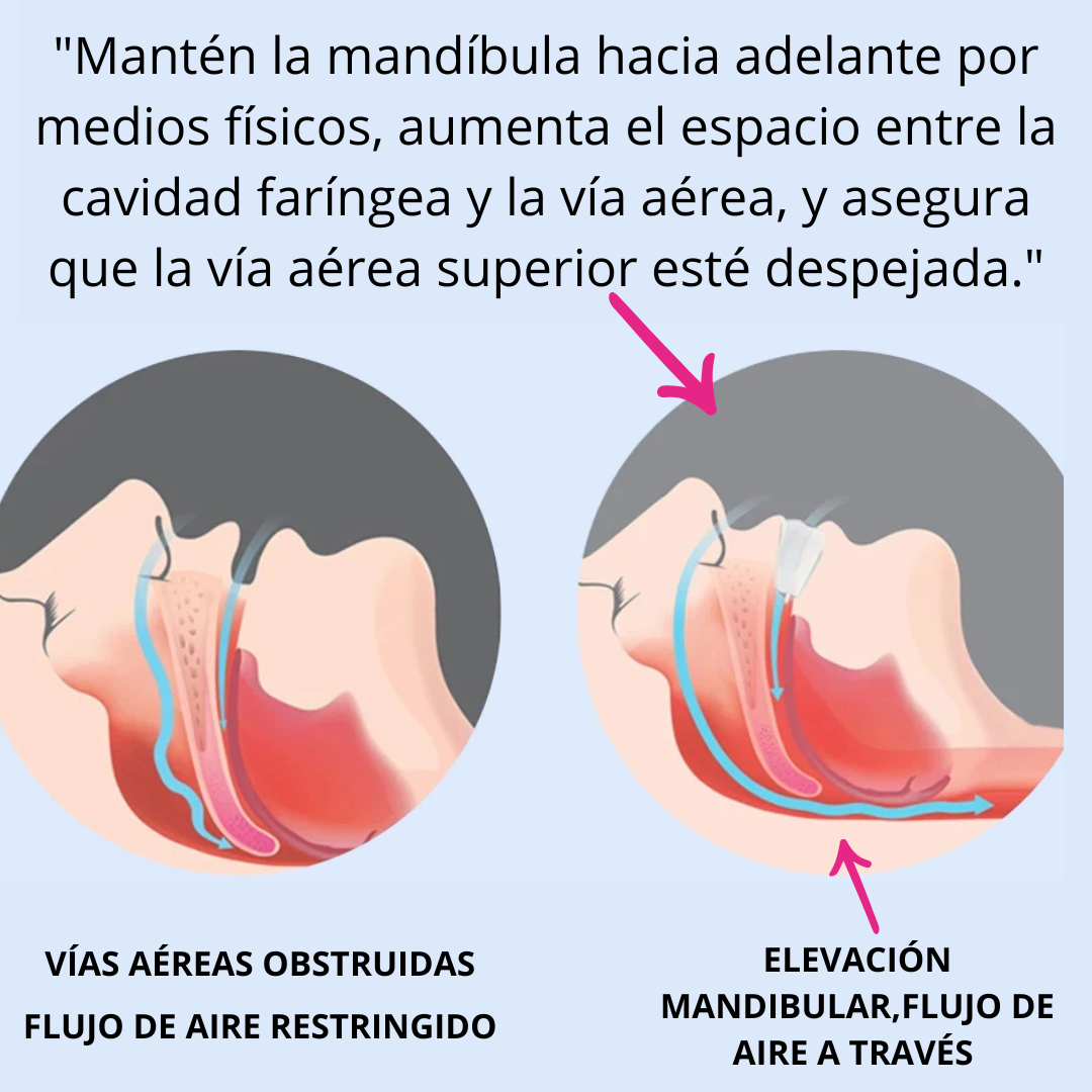 Dispositivo Antirronquidos APFLEX