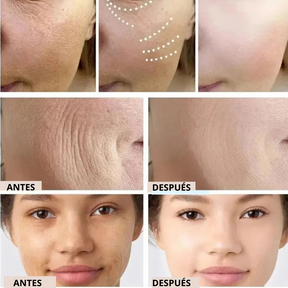 COLLAGEN REVERSE FILM