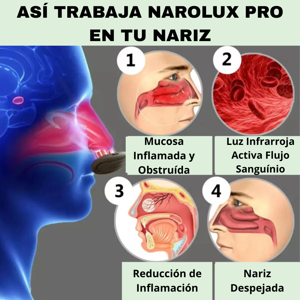 Narolux Pro -Dispositivo  Nasal  con Tecnología Láser Infrarroja
